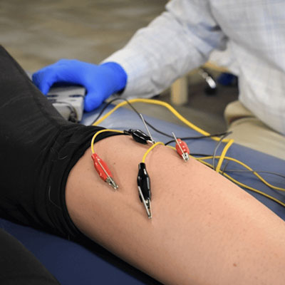 Dry Needling